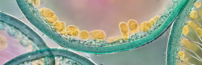 Photo showing microscopic parts of bacterial growth on a Petri glass